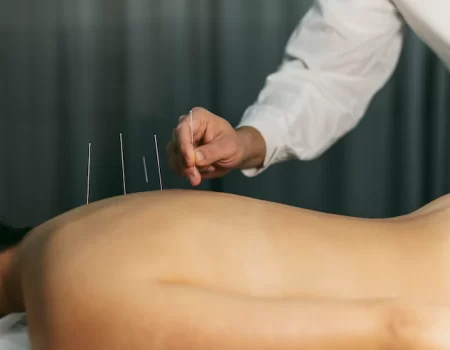 Acupuntura: uma terapia eficaz ou um efeito placebo?