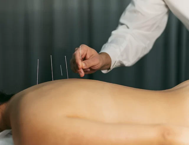 Acupuntura: uma terapia eficaz ou um efeito placebo?