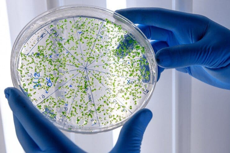 Superbactérias: entenda o problema que mata milhares de pessoas no Brasil e no mundo